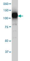 Anti-SIRT1 Mouse Monoclonal Antibody [clone: 7B7]