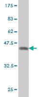 Anti-QPRT Mouse Monoclonal Antibody [clone: 5D11]