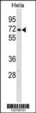 Anti-CPSF6 Rabbit Polyclonal Antibody (APC (Allophycocyanin))