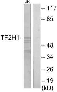 Western blot analysis of lysates from Jurkat cells using Anti-TF2H1 Antibody. The right hand lane represents a negative control, where the antibody is blocked by the immunising peptide