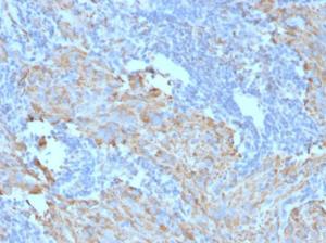 Anti-c-Kit Mouse Monoclonal Antibody [clone: C117/370]