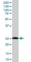 Anti-C21ORF33 Mouse Polyclonal Antibody