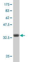 Anti-TNNT3 Mouse Polyclonal Antibody