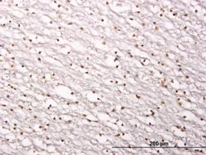 Anti-SIRT1 Mouse Monoclonal Antibody [clone: 7B7]