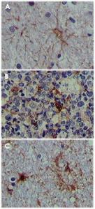 Anti-S100 A1 Mouse Monoclonal Antibody [clone: 2C8B8,2C8E8,3C8D8]