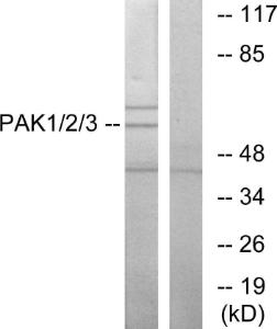 Western blot analysis of lysates from NIH/3T3 cells using Anti-PAK1 + PAK2 + PAK3 Antibody. The right hand lane represents a negative control, where the Antibody is blocked by the immunising peptide