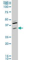 Anti-RNF41 Mouse Monoclonal Antibody [clone: 4C2]