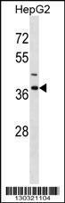 Anti-IGBP1 Rabbit Polyclonal Antibody (HRP (Horseradish Peroxidase))