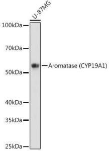 Western blot analysis of extracts of U-87MG cells, using Anti-Aromatase Antibody [ARC0635] (A307975) at 1:1000 dilution