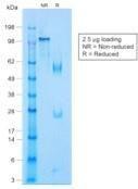 SDS-PAGE analysis of Anti-p63 Antibody [TP63/1423R] under non-reduced and reduced conditions; showing intact IgG and intact heavy and light chains, respectively. SDS-PAGE analysis confirms the integrity and purity of the antibody.