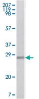 Anti-S100 A1 Mouse Monoclonal Antibody [clone: 2C8B8,2C8E8,3C8D8]