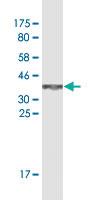 Anti-SP1 Mouse Monoclonal Antibody [clone: 4H6]