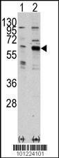 Anti-PAK3 Rabbit Polyclonal Antibody (Biotin)