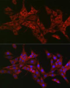 Immunofluorescence analysis of PC-12 cells using Anti-CIKS / ACT1 Antibody (A12017) at a dilution of 1:50 (40x lens). DAPI was used to stain the cell nuclei (blue)