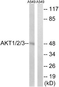 Western blot analysis of lysates from A549 cells using Anti-AKT1 + AKT2 + AKT3 Antibody The right hand lane represents a negative control, where the antibody is blocked by the immunising peptide