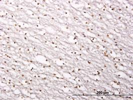 Anti-SIRT1 Mouse Monoclonal Antibody [clone: 7B7]