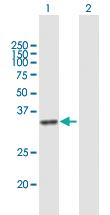 Anti-DHRSX Mouse Polyclonal Antibody