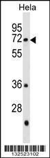 Anti-GALNT13 Rabbit Polyclonal Antibody (AP (Alkaline Phosphatase))