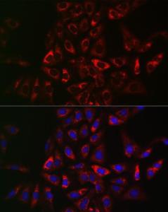 Immunofluorescence analysis of U2OS cells using Anti-CIKS / ACT1 Antibody (A12017) at a dilution of 1:50 (40x lens). DAPI was used to stain the cell nuclei (blue)