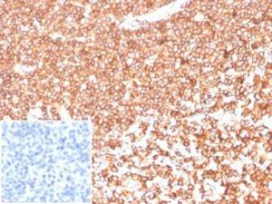 Immunohistochemical analysis of formalin-fixed, paraffin-embedded human tonsil tissue using Anti-beta Actin Antibody [ACTB/1108]. Inset: PBS instead of the primary antibody. Secondary antibody negative control