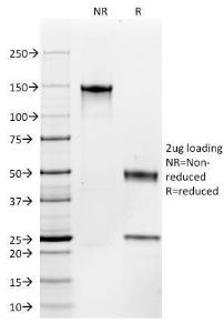 Anti-c-Kit Mouse Monoclonal Antibody [clone: C117/370]