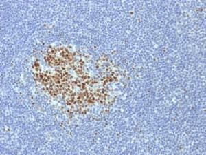 Immunohistochemical analysis of formalin-fixed, paraffin-embedded human tonsil using Anti-Bcl-6 Antibody [BCL6/1718]