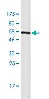 Anti-CRACR2B Mouse Monoclonal Antibody [clone: 2F10]