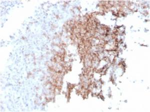 Immunohistochemical analysis of formalin-fixed, paraffin-embedded human spleen using Anti-CD21 Antibody [rCR2/1952]