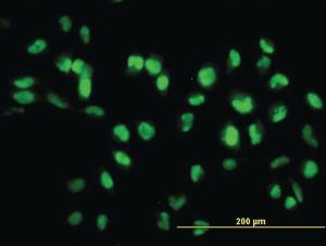 Anti-SIRT1 Mouse Monoclonal Antibody [clone: 7B7]