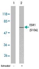 Anti-ESR1 Rabbit Polyclonal Antibody