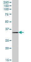 Anti-DHRSX Mouse Polyclonal Antibody