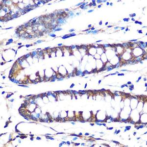 Immunohistochemistry analysis of paraffin-embedded human colon tissue using Anti-Aromatase Antibody [ARC0635] (A307975) at a dilution of 1:100 (40x lens)