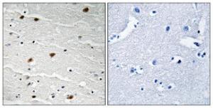 Immunohistochemical analysis of paraffin-embedded human brain tissue using Anti-AKT1 + AKT2 + AKT3 Antibody The right hand panel represents a negative control, where the antibody was pre-incubated with the immunising peptide