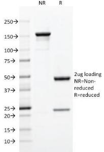 SDS-PAGE analysis of Anti-CD5 Antibody [C5/473] under non-reduced and reduced conditions; showing intact IgG and intact heavy and light chains, respectively. SDS-PAGE analysis confirms the integrity and purity of the antibody