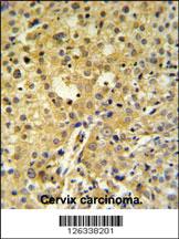 Anti-C2orf49 Rabbit Polyclonal Antibody