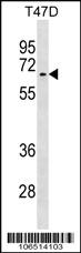 Anti-ACVR1 Rabbit Polyclonal Antibody