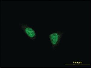 Anti-TSHZ1 Mouse Monoclonal Antibody [clone: 2F1]