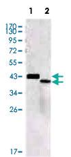 Anti-SORL1 Mouse Monoclonal Antibody [clone: 7D7B11]