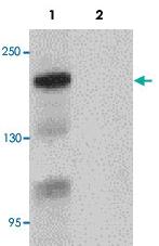 Anti-BCL9L Rabbit Polyclonal Antibody