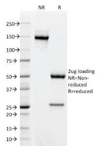 SDS-PAGE analysis of Anti-Bcl-6 Antibody [BCL6/1718] under non-reduced and reduced conditions; showing intact IgG and intact heavy and light chains, respectively. SDS-PAGE analysis confirms the integrity and purity of the antibody