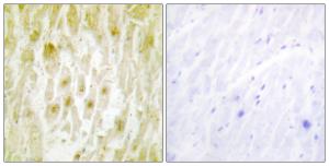 Antibody anti-TF2E2 100 µg