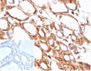 Immunohistochemical analysis of formalin-fixed, paraffin-embedded human thyroid tissue using Anti-beta Actin Antibody [ACTB/1108]. Inset: PBS instead of the primary antibody. Secondary antibody negative control