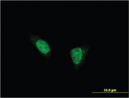 Anti-TSHZ1 Mouse Monoclonal Antibody [clone: 2F1]