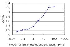 Anti-SIRT1 Mouse Monoclonal Antibody [clone: 7B7]