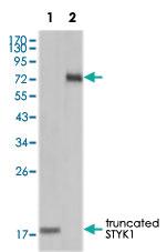 Anti-STYK1 Mouse Monoclonal Antibody [clone: 2H2F10]