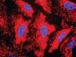 Anti-CDKN1A Antibody Pair