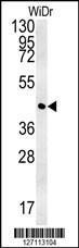 Anti-CCYL1 Rabbit Polyclonal Antibody (AP (Alkaline Phosphatase))