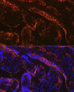 Immunofluorescence analysis of human placenta using Anti-Aromatase Antibody [ARC0635] (A307975) at a dilution of 1:100 (40x lens). DAPI was used to stain the cell nuclei (blue)