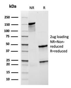 SDS-PAGE analysis of Anti-CD21 Antibody [rCR2/1952] under non-reduced and reduced conditions; showing intact IgG and intact heavy and light chains, respectively. SDS-PAGE analysis confirms the integrity and purity of the antibody.