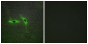 Immunofluorescence analysis of HepG2 cells using Anti-TNFRSF6B Antibody. The right hand panel represents a negative control, where the antibody was pre-incubated with the immunising peptide